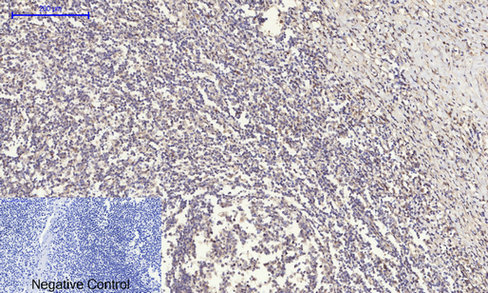 14 - SOCS-1 Polyclonal Antibody AP72545