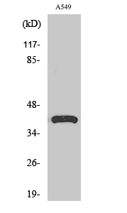 1 - SP-B Polyclonal Antibody AP72563