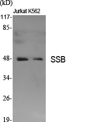 1 - SSB Polyclonal Antibody AP72608