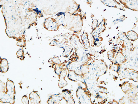 14 - TGase2 Polyclonal Antibody AP72808