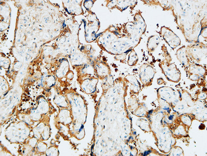 14 - TGase2 Polyclonal Antibody AP72808