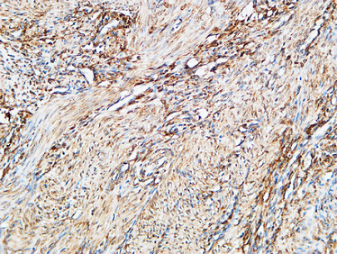 14 - TGase2 Polyclonal Antibody AP72808