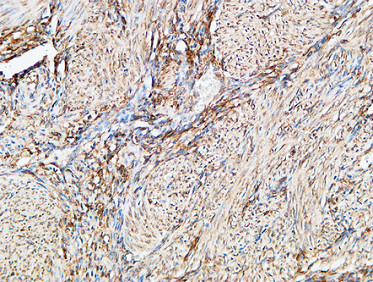 14 - TGase2 Polyclonal Antibody AP72808