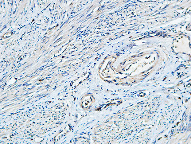 14 - TIMP-1 Polyclonal Antibody AP72841