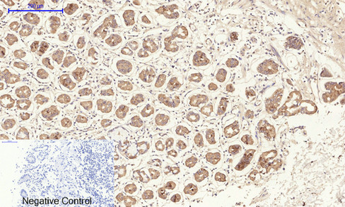 14 - TIMP-1 Polyclonal Antibody AP72841