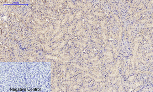 14 - TIMP-1 Polyclonal Antibody AP72841