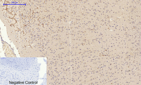 14 - TIMP-1 Polyclonal Antibody AP72841