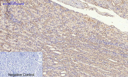 14 - TIMP-1 Polyclonal Antibody AP72841