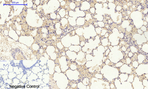 14 - TIMP-1 Polyclonal Antibody AP72841