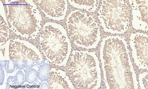 14 - TIMP-1 Polyclonal Antibody AP72841