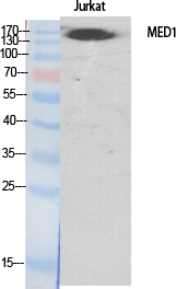1 - TRAP220 Polyclonal Antibody AP72907