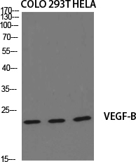 1 - VEGF-B Polyclonal Antibody AP73054