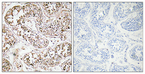 1 - VIP Polyclonal Antibody AP73066