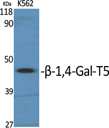 1 - β-1,4-Gal-T5 Polyclonal Antibody AP73193