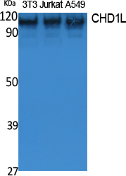 1 - CHD1L Polyclonal Antibody AP73210