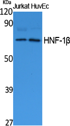1 - HNF-1β Polyclonal Antibody AP73266