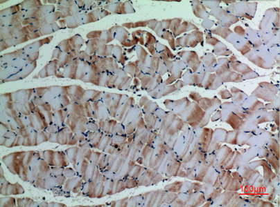 14 - α-SMA Polyclonal Antibody AP73303