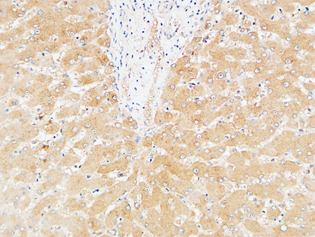 14 - Prothrombin Polyclonal Antibody AP73309