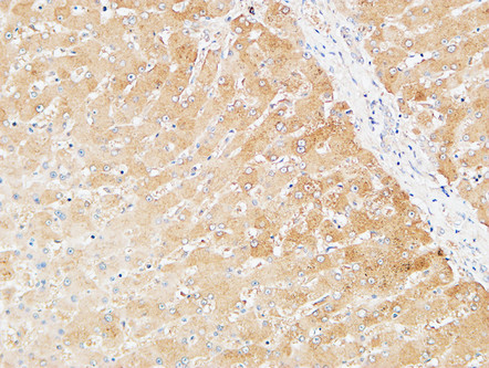 14 - Prothrombin Polyclonal Antibody AP73309