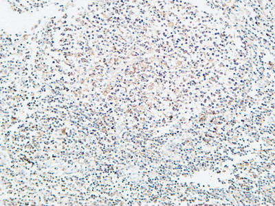 14 - Prothrombin Polyclonal Antibody AP73309