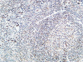 14 - Prothrombin Polyclonal Antibody AP73309