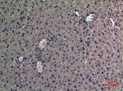 14 - Prothrombin Polyclonal Antibody AP73309