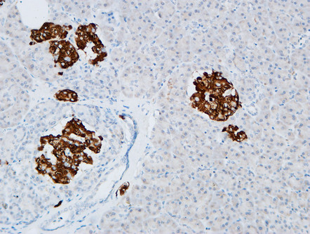 14 - CD133 Polyclonal Antibody AP73375