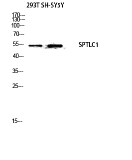 1 - SPTLC1 Polyclonal Antibody AP73415
