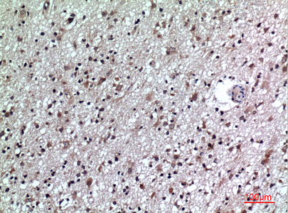 14 - CD84 Polyclonal Antibody AP73439
