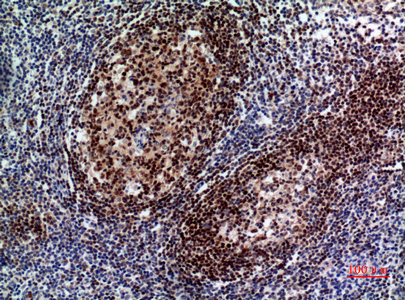 14 - Pax-5 Polyclonal Antibody AP73495