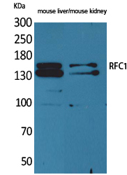 1 - RFC1 Polyclonal Antibody AP73497