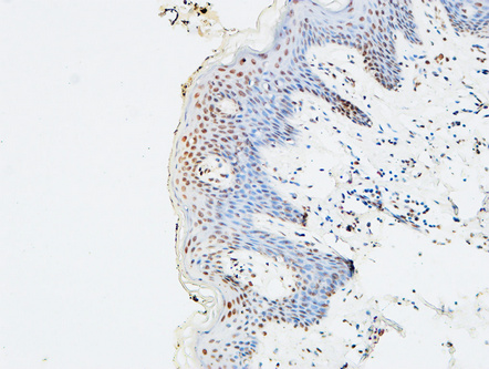 14 - p73 Polyclonal Antibody AP73526