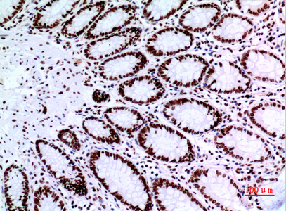14 - p73 Polyclonal Antibody AP73526