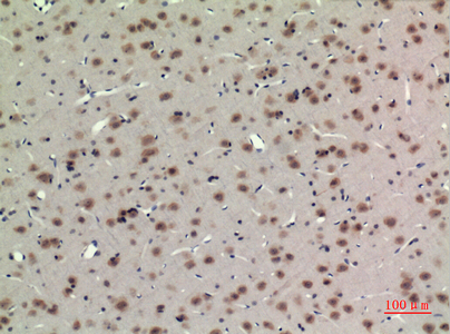 14 - BMAL1 Polyclonal Antibody AP73606