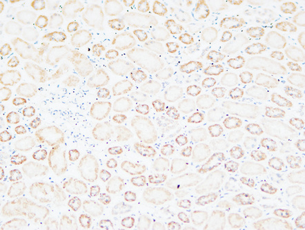 14 - Tenascin-C Polyclonal Antibody AP73731