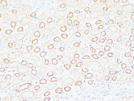 14 - Tenascin-C Polyclonal Antibody AP73731