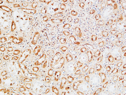 14 - M-CSF Polyclonal Antibody AP73736