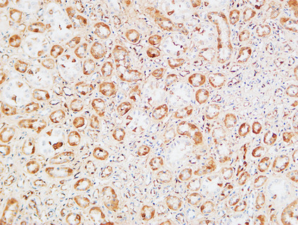 14 - M-CSF Polyclonal Antibody AP73736