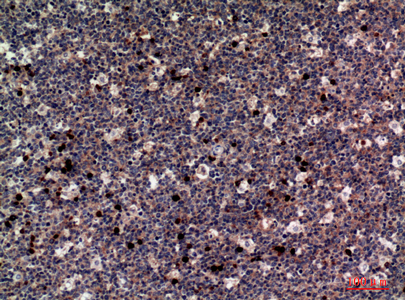 14 - M-CSF Polyclonal Antibody AP73736