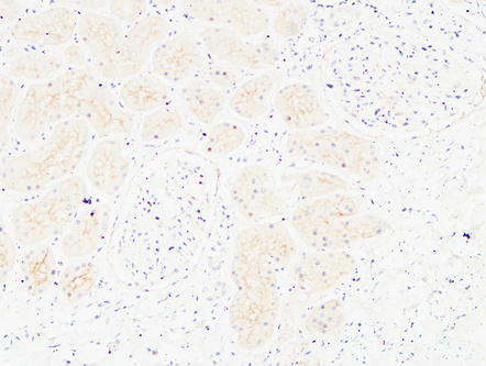 14 - CD13 Polyclonal Antibody AP73762