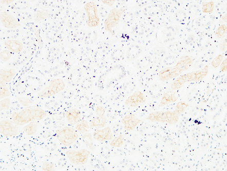 14 - CD13 Polyclonal Antibody AP73762