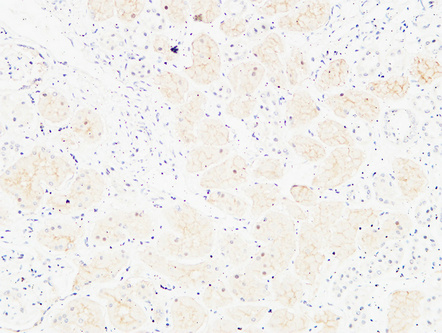 14 - CD13 Polyclonal Antibody AP73762