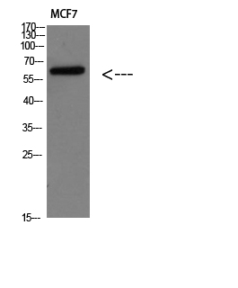 1 - Parathyroid hormone/parathyroid hormone-related peptide receptor Polyclonal Antibody AP74039