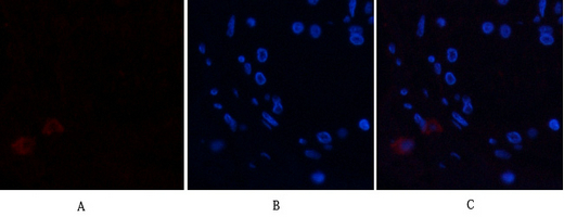 3 - Annexin I Polyclonal Antibody AP74055