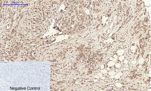 14 - Annexin I Polyclonal Antibody AP74055