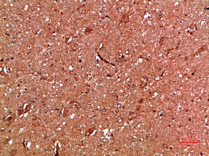 14 - Annexin I Polyclonal Antibody AP74055