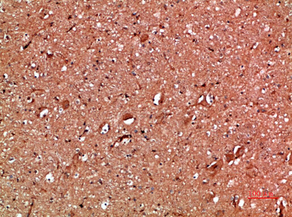 14 - Annexin I Polyclonal Antibody AP74055