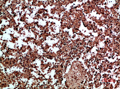 14 - Annexin I Polyclonal Antibody AP74055