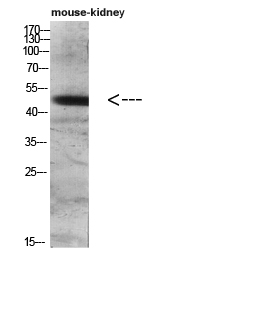 1 - DC-LAMP Polyclonal Antibody AP74074