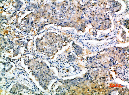 14 - SOCS-3 Polyclonal Antibody AP74099